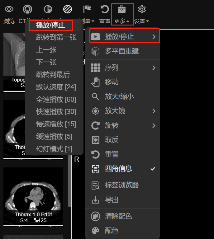 播放
