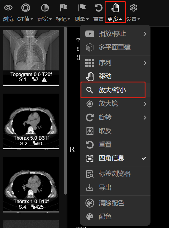 放大/缩小