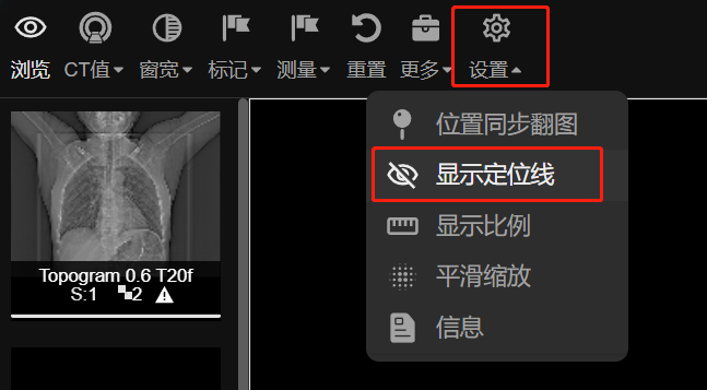 定位线
