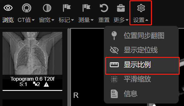 显示比例