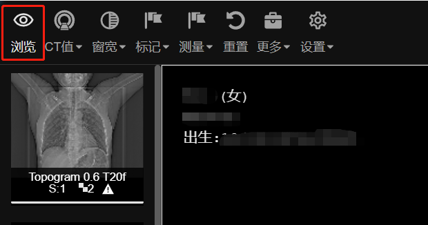 浏览