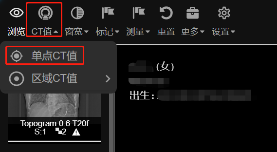 CT值