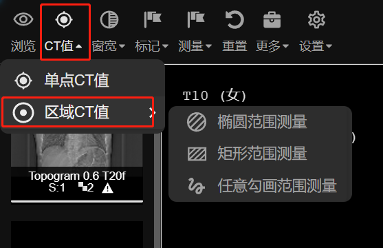 CT值