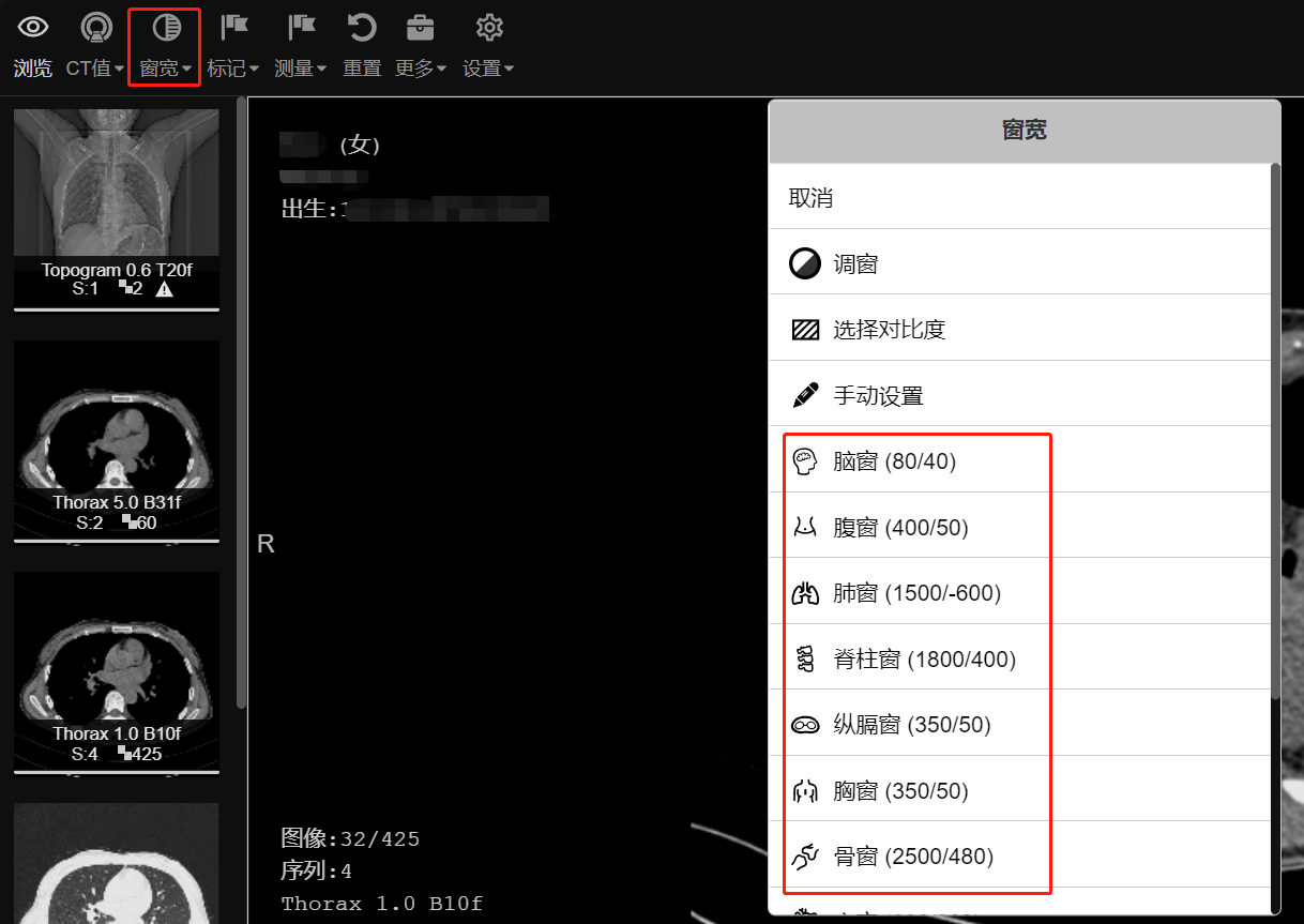 窗宽
